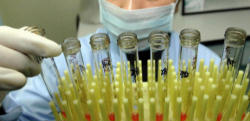 Image of Since the beginning of the 21st Century, the positive results from research using adult stem cells has increased at an astonishing rate, whereas embryonic stem cell research, mired in technical problems, has failed miserably to live up to the promises of its proponents. The use of embryonic stem cells is condemned by the Church because it always requires that the life of an embryo be taken to produce the cells. As a culture, we would create children to be killed for research in the “hope” (does that term sound familiar?) of discovering something that could be useful clinically.