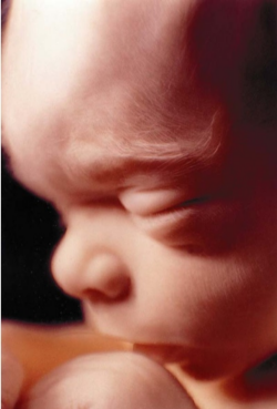 Image of On June 25, 19 Democrats, 11 of whom are Catholic, sent a letter to House Speaker Nancy Pelosi saying they will not vote for healthcare reform 'unless it explicitly excludes abortion funding' from the plan.