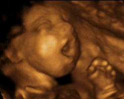 Image of What a lasting blessing this piece could be to the Pro-Life community, and a powerful means of reaching indifferent hearts! 