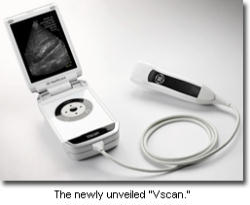 Image of Vscan, an ultrasound machine about the size of a large flip phone.