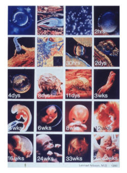 Image of From the time that the ovum is fertilized, a new life is begun which is neither that of the father nor of the mother; it is rather the life of a new human being with his own growth.  It would never be made human if it were not human already.  To this perpetual evidence…modern genetic science brings valuable confirmation.  It has demonstrated that, from the first instant, the program is fixed as to what this living being will be: a man, this individual man with his individual characteristics already determined.”  (Declaration on Procured Abortion, 1974)  