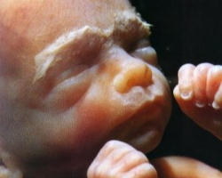 Image of 'Personhood is a revolution of the pro-life movement,' stated Keith Mason, co-founder of Personhood USA. 'It challenges what's been done in the past, stimulates the movement's present, and eradicates the need for pro-life efforts in the future. Personhood is the best hope to end abortion in America.'