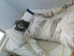 Image of Arshed Masih, 38, is still fighting for his life in Holy Family Hospital.