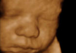 Image of Surgeons true to their oath to do no harm now use this technology to help them operate on these little girls and boys while they are growing in the first home of their mother's womb. Yet, others use the same technology to assist them in killing them. 

