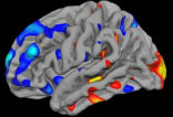 Image of Research suggests that brain scans may be used as an early indicator of autism.