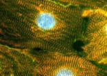 Image of Adult Stem Cells hold great promise and research in this field is encouraged and supported by the Catholic Church