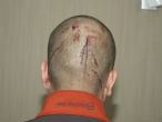 Image of This image shows that Zimmerman clearly sustained injuries to the back of his head. 