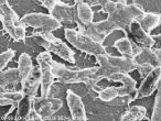 Image of Flesh eating bacteria as viewed under an electron microscope. 
