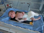 Image of A starving baby in a Syrian hospital. Food and medicine are virtually exhausted creating a famine situation. The regime is accused of trying to starve people into submission.
