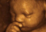 Image of 3D/4D Ultrasound