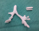 Image of A picture of the implant created for baby Kaiba on a 3D printer.