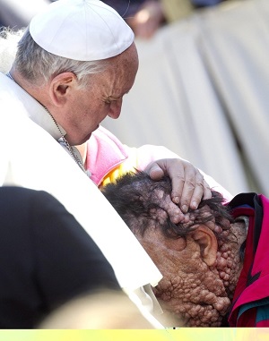 Francis hugs the poor. Francis hugs the poor.
