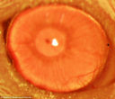 Image of Adult stem cells have allowed scientist to regrow cornea tissue which could help cure blindness.
