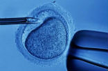 Image of In vitro fertilization requires the conception of several children in a test-tube to maximize the outcome of success, but then the unwanted children are destroyed before being implanted into their mother's womb. 