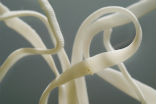 Image of A type of parasitic tapeworm, just a little over 0.3 inches in length, burrowed its way through the brain of a British man for four years.