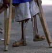 Image of Doctors have no idea what is really causing paralysis in more than 100 kids throughout the United States.