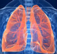 Image of Legionnaires' disease is a lung bacteria that causes flue-like muscle pain, headaches, fevers, drowsiness, chills and in some cases delirium.