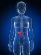 Image of A simple blood test can predict kidney disease five years before kidney damage begins.