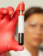 Image of A new blood test can tell if a child has Down Syndrome.