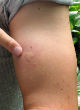 Image of CDC releases new Zika warning (CDC).