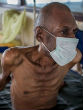 Image of WHO considers new TB treatment (Philippe Schneider/World Vision).