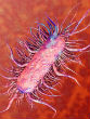 Image of A woman has been diagnosed with a frightening E. coli superbug in Pennsylvania (Inhabitat).