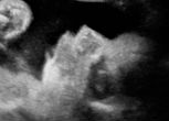 Image of Mother sees ultrasound of her son and was left untouched (Heather Neal).