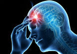 Image of How can you prevent a stroke?