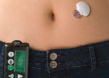 Image of An artificial pancreas can help women suffering diabetes.