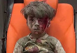 Image of Omran Daqneesh, dazed and soaked in his own blood, witnessed his home being destroyed (Polaris).