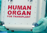 Image of Is it right to kill coma patients for their organs?