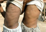 Image of Illegal migrants are coerced to sell their organs in exchange for money or sex.