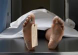 Image of Thousands die each year as antibiotic-resistant infections strike hard.