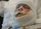 Image of A 10-year-old boy special needs boy was set on fire by another child (Team Kayden/GoFundMe).