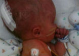 Image of Noah's parents refused to deny him a chance at life (Noah Wall Model/Facebook).