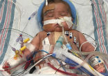 Image of Baby Henry was born with two serious heart conditions (Hope for Henry/Facebook).