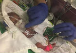 Image of Baby born at 25-weeks weighed only 14-ounces (PA Real Life).