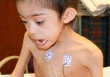 Image of Giovanni Eastwood was discovered starving and emaciated in his mother's attic (Family Handout).