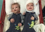 Image of Jadon and Anias McDonald survived separation surgery (Nicole McDonald/Facebook).