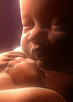 Lawmakers push to put an end to abortions.