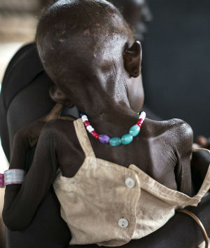 5.5 million people are starving in South Sudan.