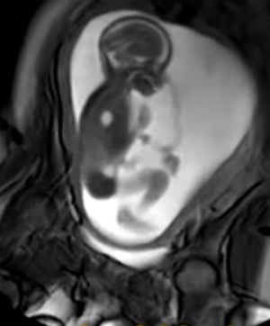 These MRI scans are taking images to the next level.