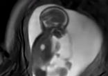 Image of These MRI scans are taking images to the next level.
