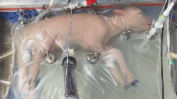 A lamb can be raised in an artificial womb. Humans are next.