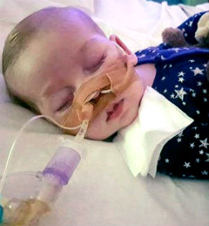 Charlie Gard was born with the Mitochondrial DNA depletion syndrome.