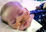 Image of Charlie Gard was born with the Mitochondrial DNA depletion syndrome.