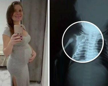 Claudineia dos Santos Melo was nine-months-pregnant when a bullet struck her baby.