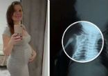 Image of Claudineia dos Santos Melo was nine-months-pregnant when a bullet struck her baby.
