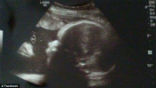 Image of Can you spot the face of Jesus in the ultrasound? 