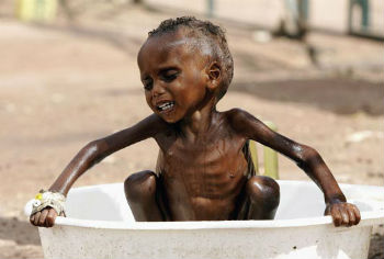 Over 20 million people in South Sudan, Somalia, Northeast Nigeria, and nearby Yemen are facing famine and starvation.